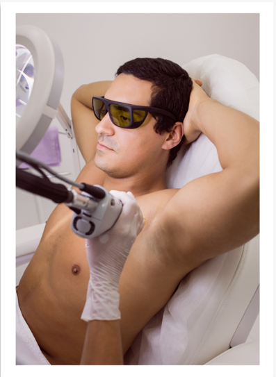 Men's Laser Treatment 2
