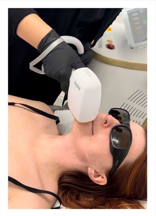 Women's Laser Treatment 1